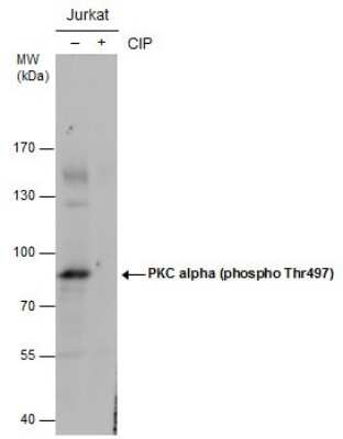 Western Blot: PKC alpha [p Thr497] Antibody [NBP3-12925]